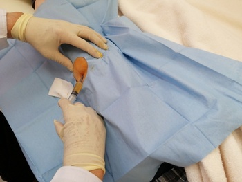 (Injection of PRP) Injecting PRP prepared in the hospital into the diseased area.