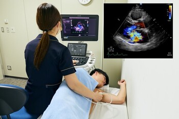 Echocardiography