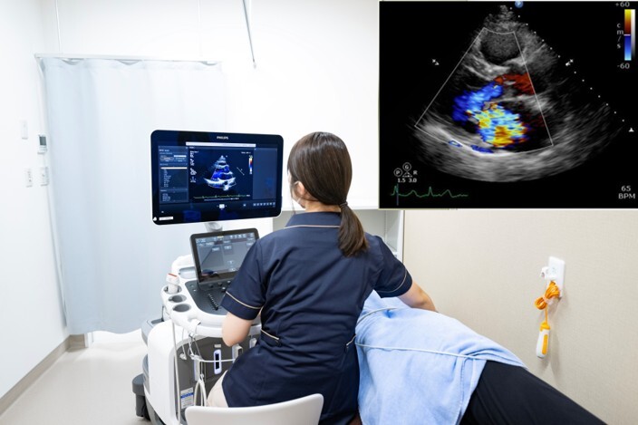 Echocardiography