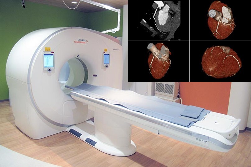 CT examination