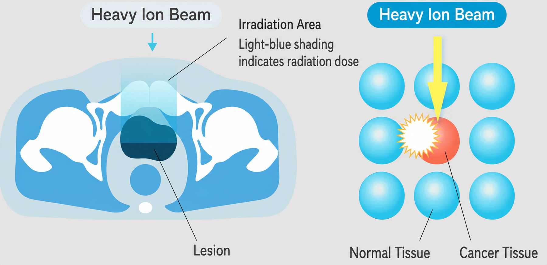 Heavy Ion Therapy Image 1