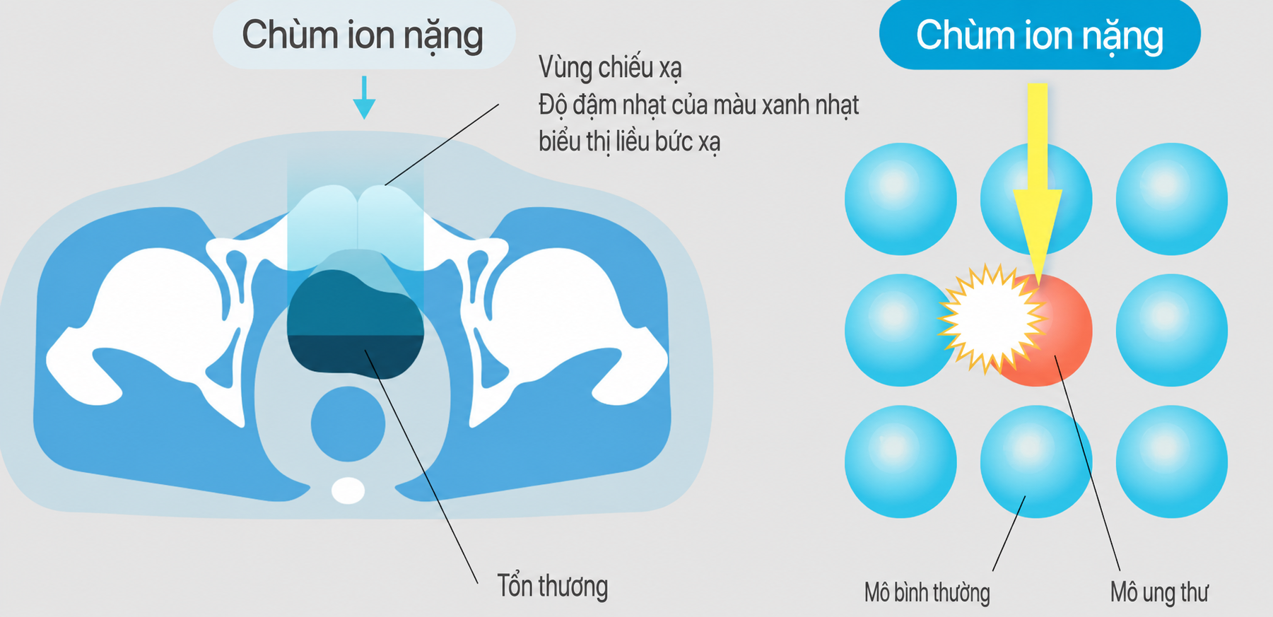 Hình ảnh xạ trị ion nặng 1