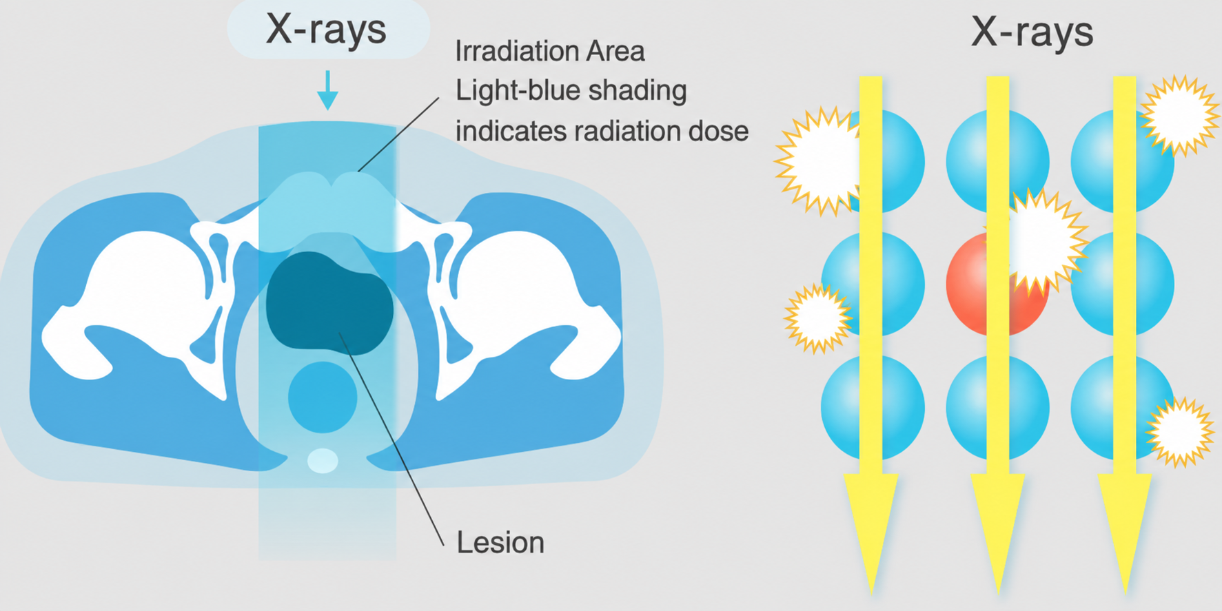 Heavy Ion Therapy Image 2