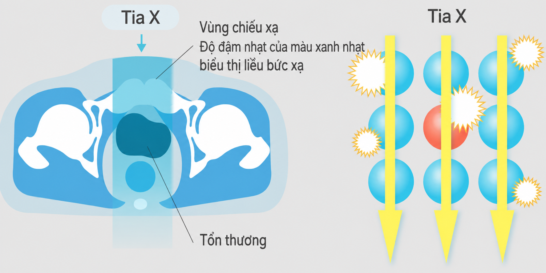Hình ảnh xạ trị ion nặng 2