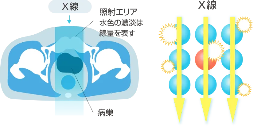 Heavy Ion Therapy Image 2